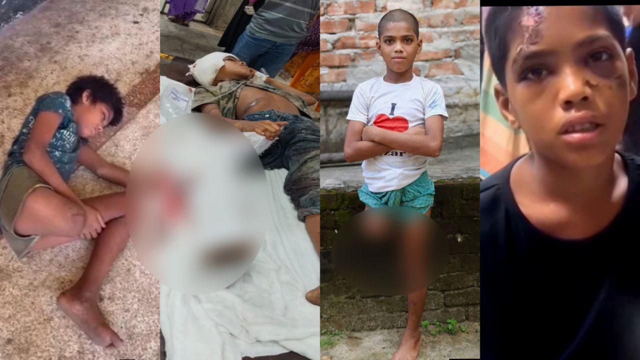 চক্রের ফাঁদ নয়, ট্রেন দুর্ঘটনাতেই পা হারায় রায়হান